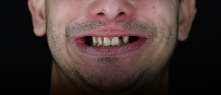 Slučaj 8, pre lečenja